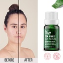 FARMSAI C DR TUNA SERUM TEA TREE 